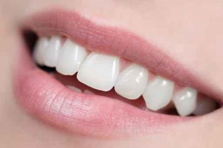 Witte tanden